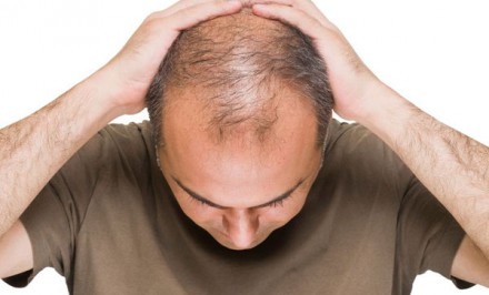 দুঃসংবাদ, টাকওয়ালাদের করোনায় আক্রান্ত হওয়ার সম্ভাবনা আড়াইগুণ বেশি!