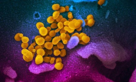 পুরুষের বীর্যে করোনাভাইরাস