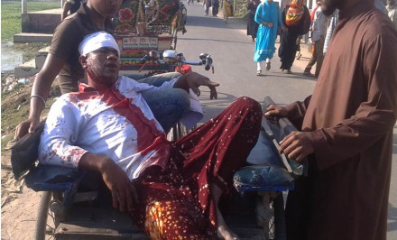 শাহজাদপুরে বস্ত্র ব্যবসায়ী সমিতির সেক্রেটারি রাজাকে কুপিয়ে জখম।