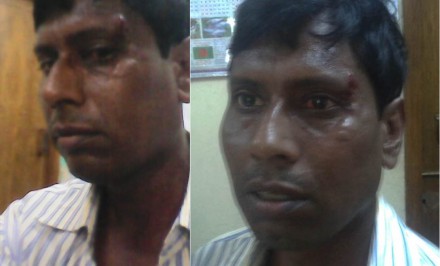 যুগান্তরের সাংবাদিক জাহান তেলচোর সন্ত্রাসীদের হামলায় গুরুত্বর আহত