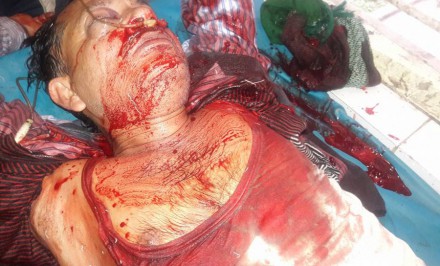 শাহজাদপুরে সমকাল সাংবাদিক গুলিবিদ্ধ : শংকাজনক অবস্থায় বগুড়া হাসপাতালে স্থানান্তর