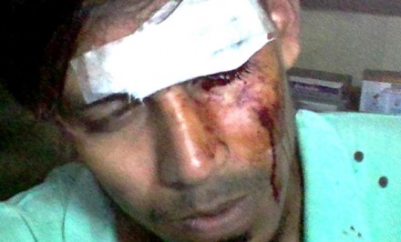 শাহজাদপুরে সন্ত্রাসী হামলায় রূপপুর রূপালী সংসদের সাংগঠনিক সম্পাদকসহ আহত ৬