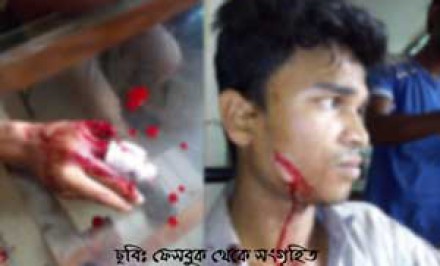 শাহজাদপুরে যুবলীগের দুই গ্রুপের রক্তক্ষয়ী হামলা সংঘর্ষঃ শিশুসহ ১২ জন আহত