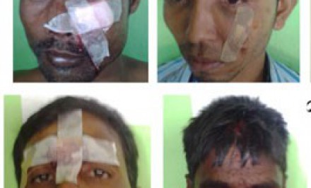 চাঁদাবাজীকে কেন্দ্র করে হামলা সংঘর্ষ - শাহজাদপুরের কৈজুরী বাজার রণক্ষেত্রঃ আহত ৩৫