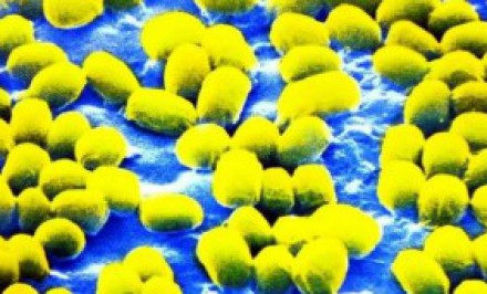 শাহজাদপুরে এ্যানথ্রাক্স আক্রান্ত এলাকা বিশেষজ্ঞ দলের পরিদর্শন