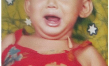 দুরারোগ্য টফ রোগে আক্রান্ত শিশু জামিলাকে বাঁচাতে এগিয়ে আসুন