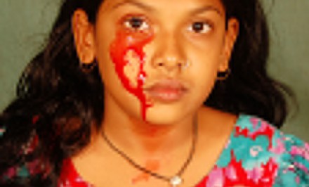 বিনা চিকিৎসায় মৃত্যুর মুখে আত্রাইয়ের মেধাবী ছাত্রী তৃষা