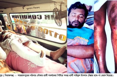 শাহজাদপুরে স্বতন্ত্র প্রার্থীর হাত-পা ভেঙ্গে দিলো নৌকার সমর্থকেরা